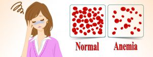 چطور از ابتلا به کم‌خونی پیشگیری کنیم؟