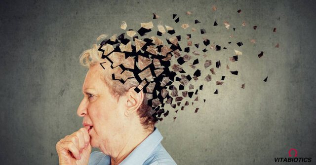 بیماری آلزایمر