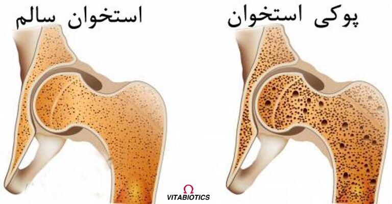 تراکم استخوان