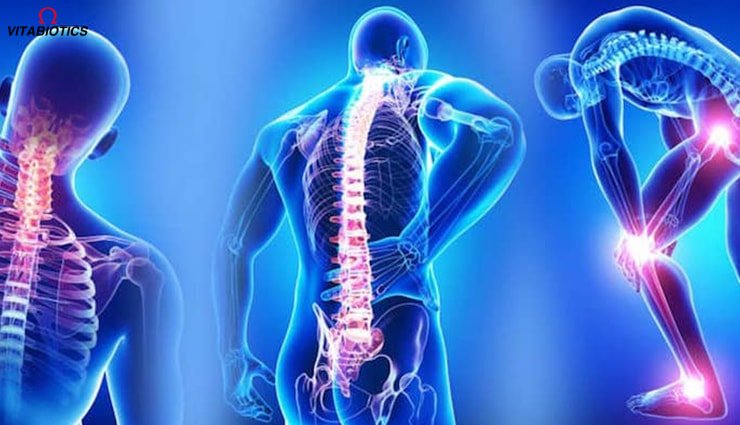 بیماری فیبرومیالوژیا