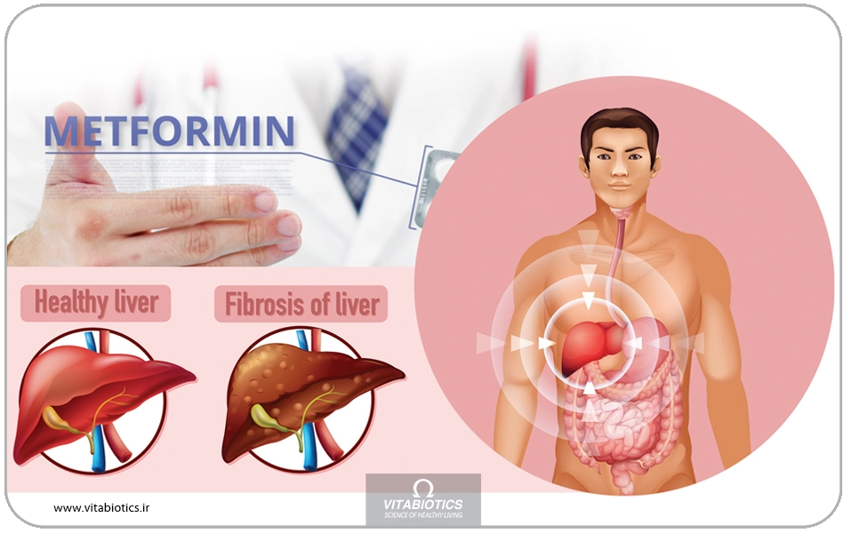 دلایل به وجود آمدن فیبروز کبدی گوناگون است و از جمله آنها میتوان به هپاتیت B و C، تخریب بافت کبدی در اثر دارو، الکل یا کبد چرب غیرالکلی اشاره کرد.